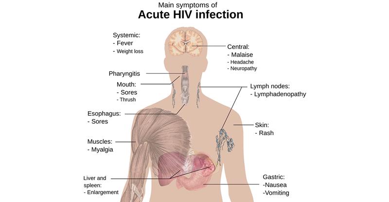 Sexually Transmitted Infections Anatomical Chart